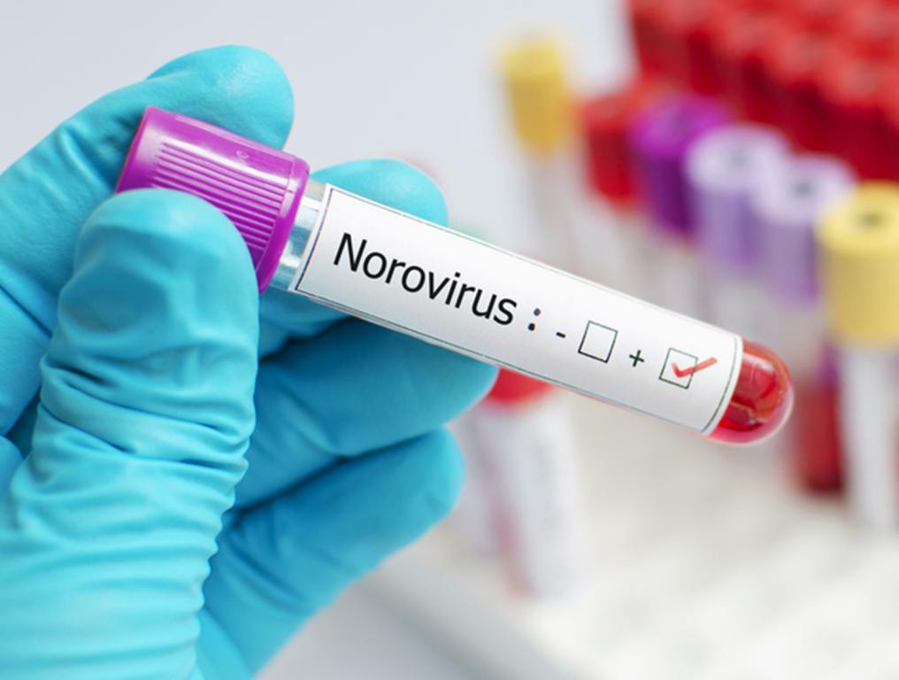 Norovirus positive blood tube